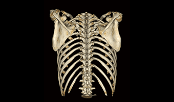 Toraks 3D VRT — TurboTom 3 Serisi klinik BT görüntüsü