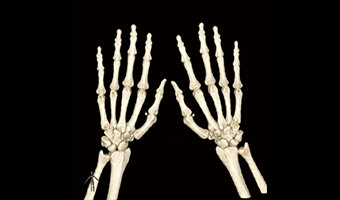 El 3D VRT — TurboTom 3S klinik BT görüntüsü