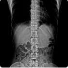 Abdomen — SG HealthCare Jumong serisi dijital radyografi görüntüsü