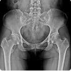 Pelvis — SG HealthCare Jumong serisi dijital radyografi görüntüsü