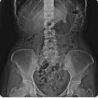 Pelvis — SG HealthCare Jumong serisi dijital radyografi görüntüsü