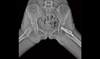 Pelvis — New Oriental serisi dijital radyografi görüntüsü