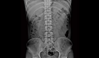 Abdomen — New Oriental serisi dijital radyografi görüntüsü