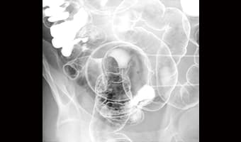 Pelvis — DRF-5 Serisi klinik floroskopi görüntüsü