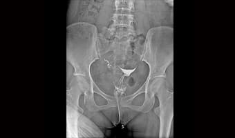 Pelvis - Kalça — DRF-7/8 Serisi klinik floroskopi görüntüsü
