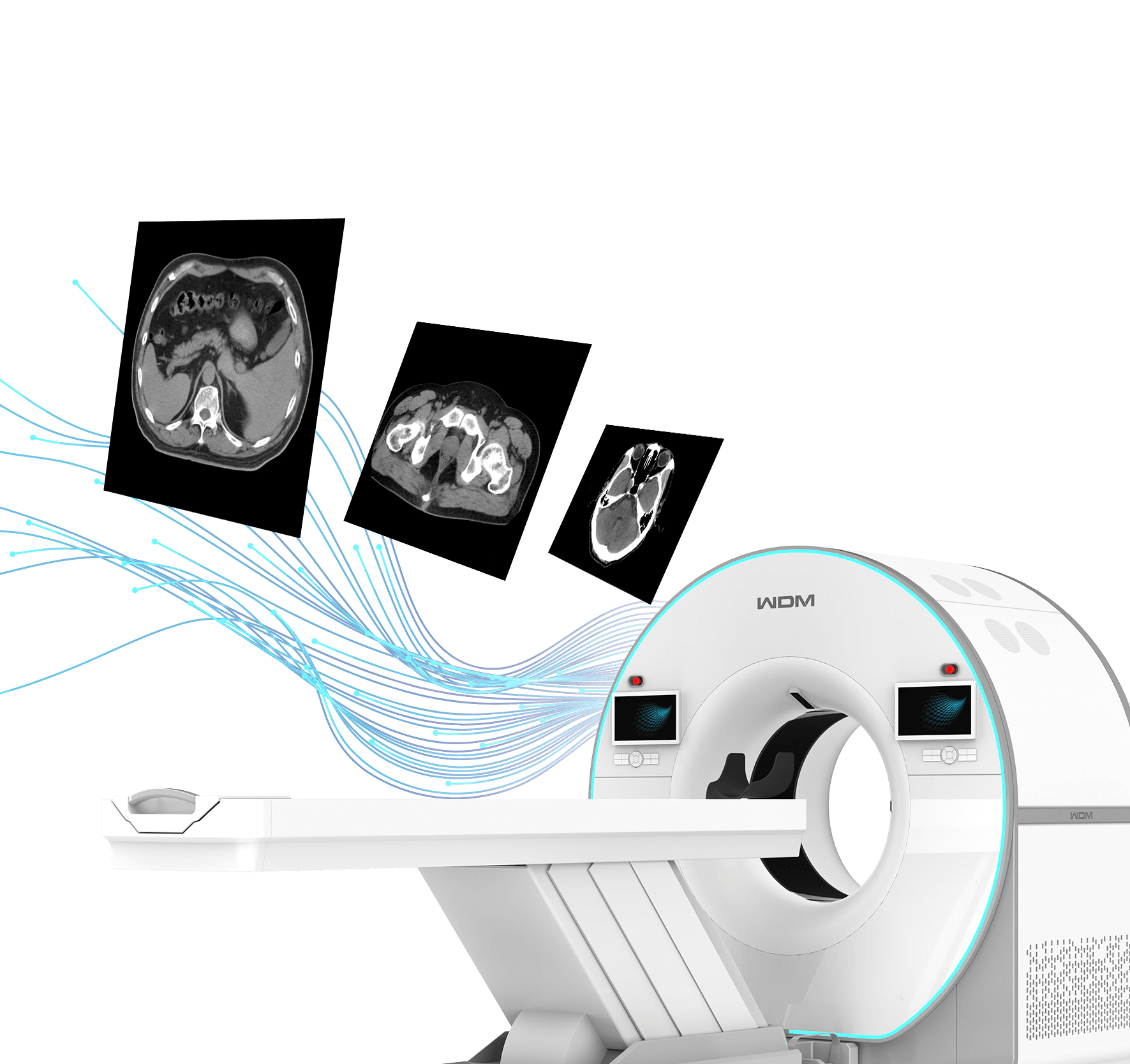 TurboTom 5S BT Sistemi klinik platform — entegre görüntüleme ekosistemi