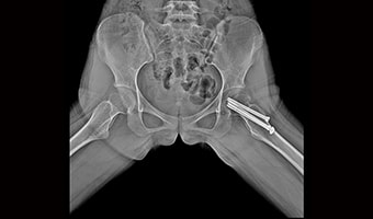 New Oriental 1000FC — Pelvis radyografisi