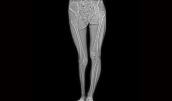 New Oriental 1000LB — Alt Ekstremite radyografisi