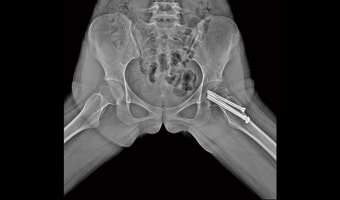 New Oriental 1000N2S — Pelvis radyografisi