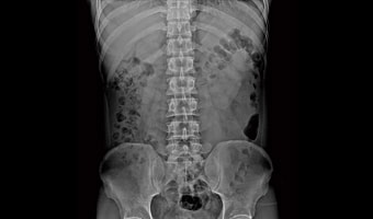 New Oriental 1000N2S — Abdomen radyografisi