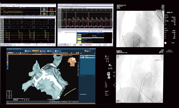 CGO-2100 PRO entegre all-in-one ekran — hemodinamik veri ve çift anjiyografi görüntüsü