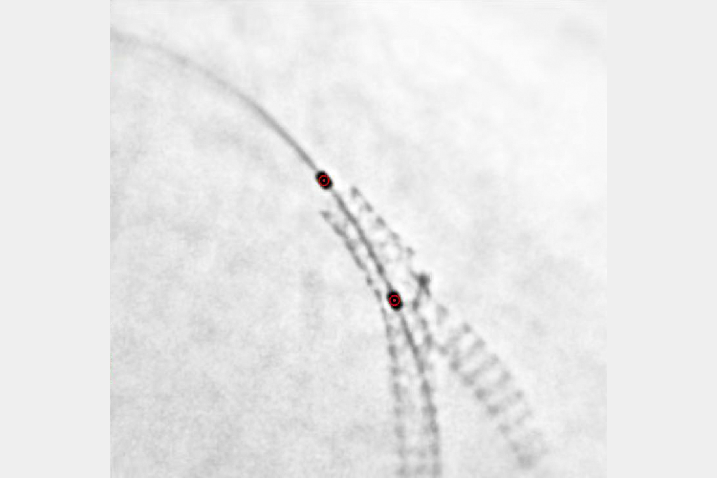Stent Görselleştirme Geliştirmesi — koroner stent büyütülmüş klinik görüntü