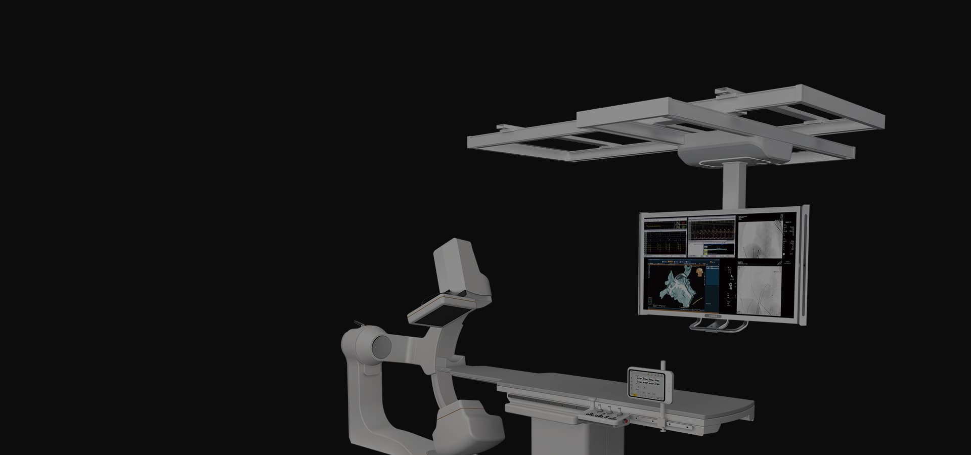 Wandong Medical CGO Serisi DSA sistemi — C-kol, hasta masası ve çift monitör istasyonu