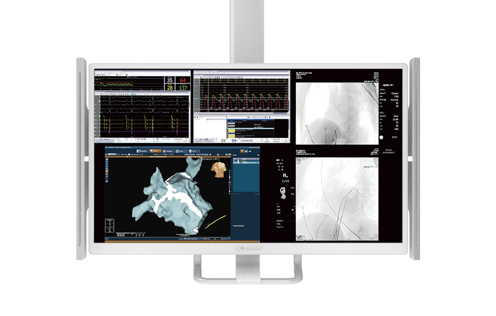 CGO-5200 PRO entegre all-in-one ekran — hemodinamik veri ve çift anjiyografi görüntüsü