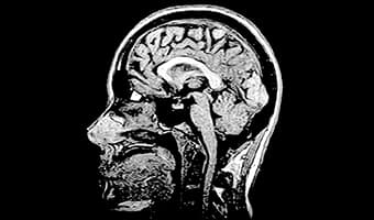 i_Open 0.4T — Beyin Sagittal T1