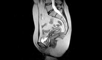 i_Open 0.4T — Pelvis Sagittal