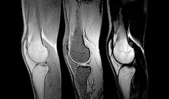 i_Open 0.4T — Diz Sagittal — Çoklu Kontrast