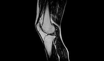 i_Open 0.4T — Diz Sagittal — Lateral