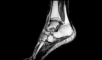 i_Open 0.5T — Ayak Bileği Sagittal