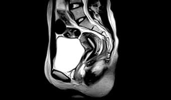 i_Open 0.5T — Pelvis Sagittal