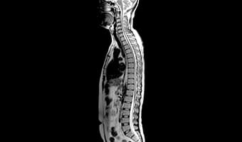 i_Open 0.5T — Tüm Omurga Sagittal Panoramik