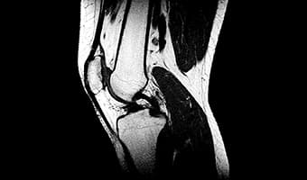 i_Open 0.5T — Diz Sagittal T2