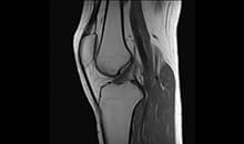 i_Space 1.5T — Diz Sagittal