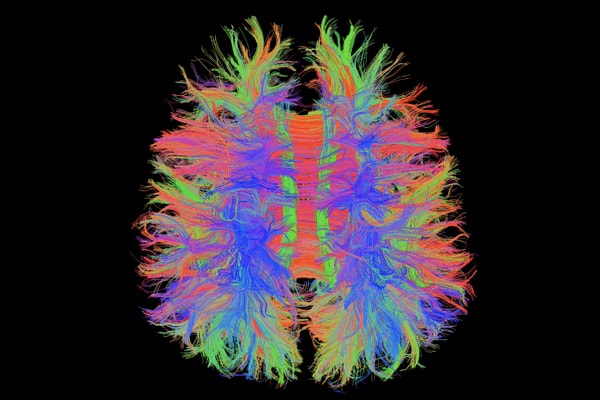 MRI Görüntüleme — Onkoloji & DWI