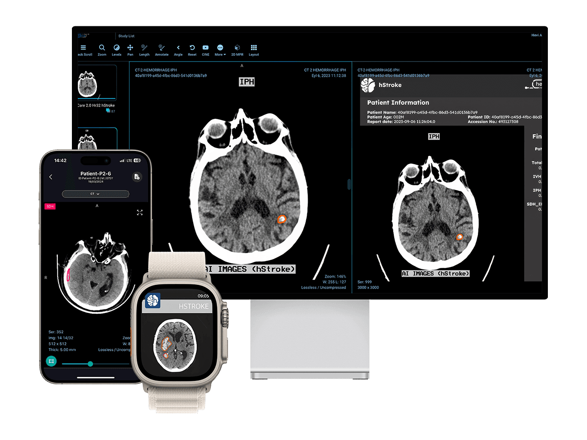 hStroke CT arayüzü